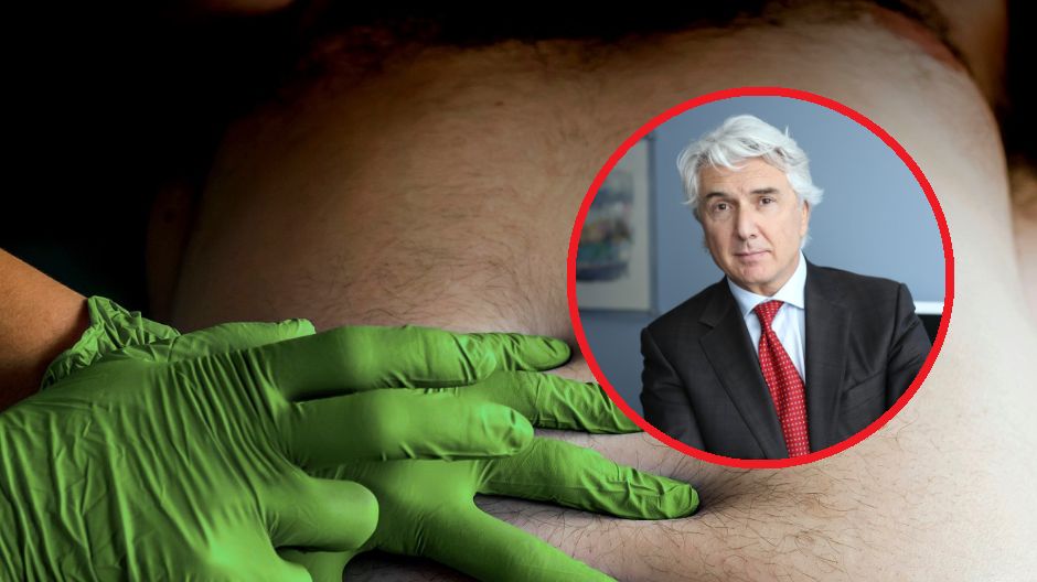 Jakie są objawy raka trzustki?