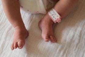 Wcześniak urodzony w 22. tygodniu ciąży uratowany. Sukces lekarzy ze Szczecina