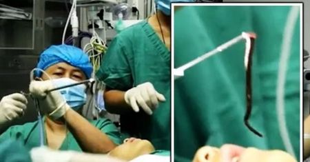 Skarżył się na ból gardła. Lekarze byli w szoku, gdy odkryli co jest przyczyną