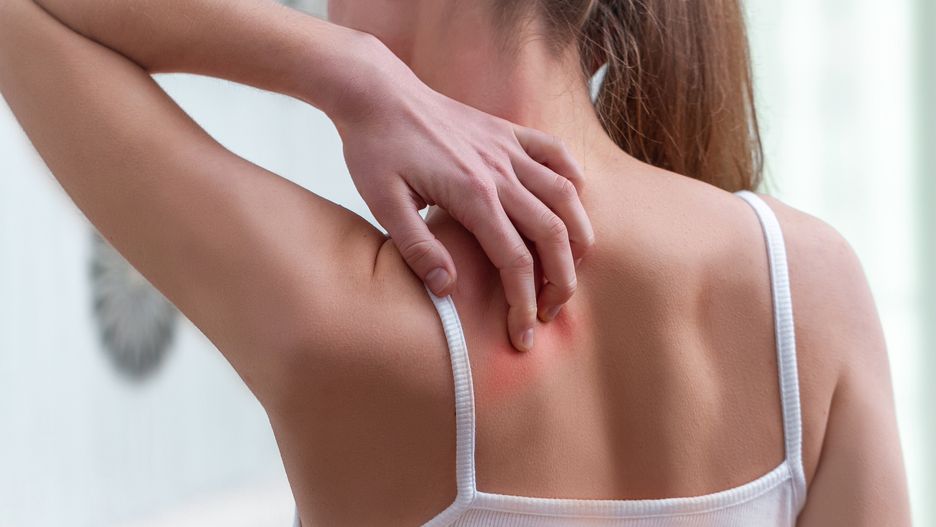 Young woman suffering from itching on her skin and scratching an itchy place. Allergic reaction to insect bites, dermatitis, food, drugs. Health care concept. Allergy rash 
allergy, allergic, scratch, itching, itchy, skin, health, rash, problem, hand, dermatology, eczema, dry, dermatitis, disease, care, finger, medicine, body, symptom, bite, pain, mosquito, prickly, sensitive, psoriasis, arm, reaction, asian, medical, insect, heat, malaria, irritation, sickness, chemicals, sensations, fungal, treatment, infection, pruritus, beauty, drug, itch, sore, allergen, blister, scratching, allergic reaction, antiallergic