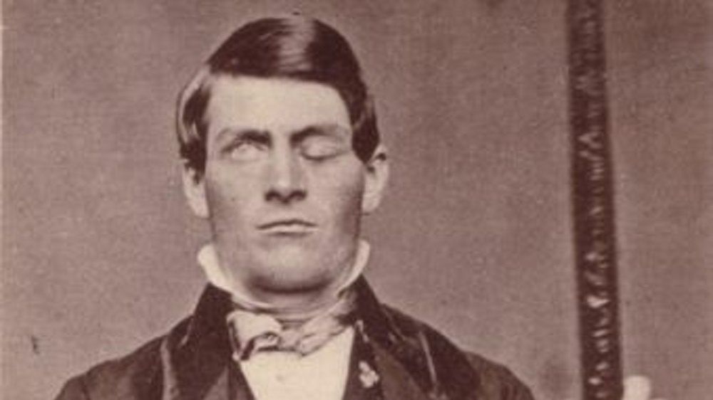 Phineas Gage