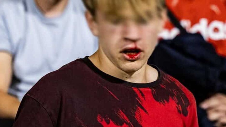 Jest tymczasowy areszt dla stadionowego agresora (źródło: wislak71 portal X)