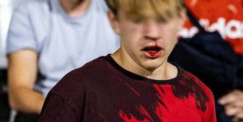 Stadionowy atak na 15‑latka. Zapadła decyzja o areszcie