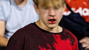 Stadionowy atak na 15‑latka. Zapadła decyzja o areszcie