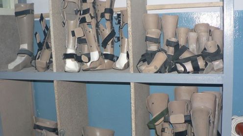 Udoskonalona proteza złagodzi bóle fantomowe 1