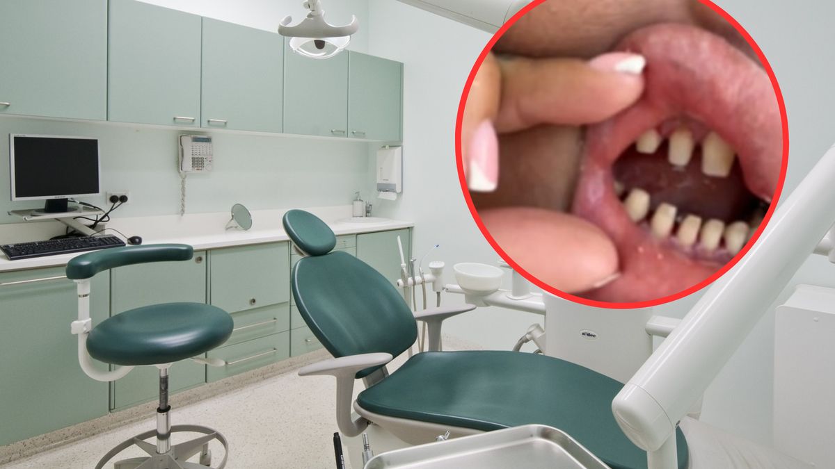 Tureckie zęby cieszą się coraz większym zainteresowaniem