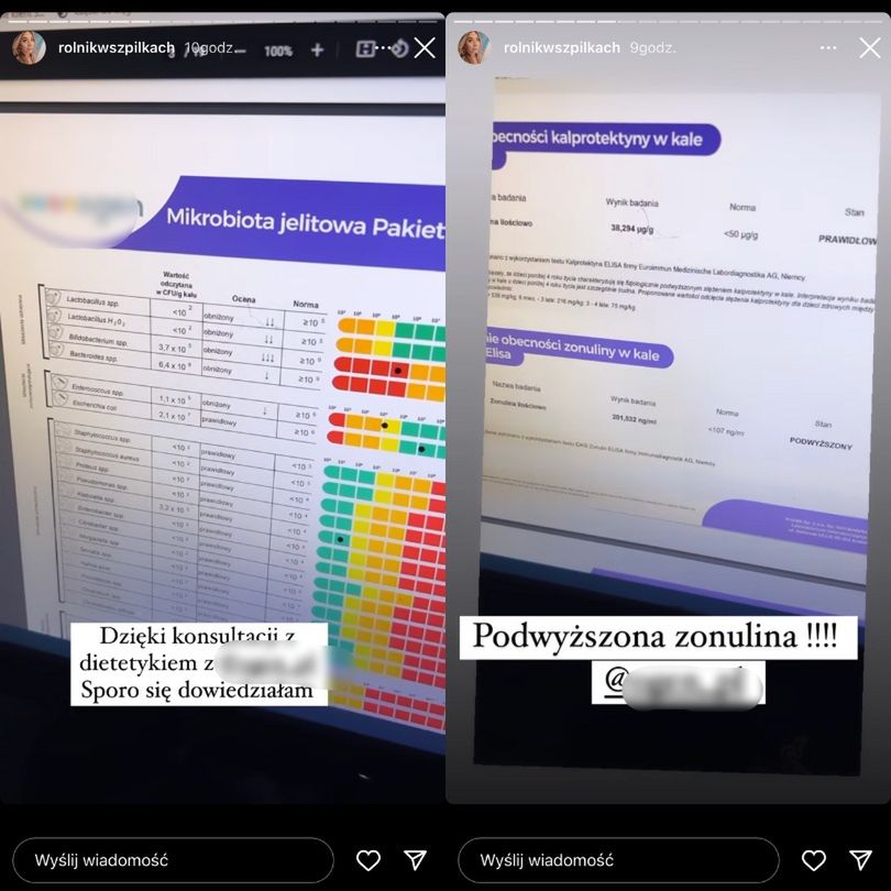 Małgorzata Borysewicz z "Rolnik szuka żony" prezentuje wyniki badania jelit