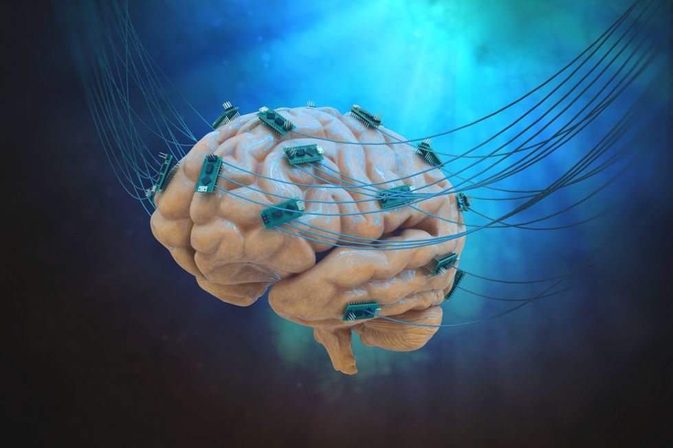 Zdjęcie mózgu z podłączonymi przewodami pochodzi z serwisu Shutterstock