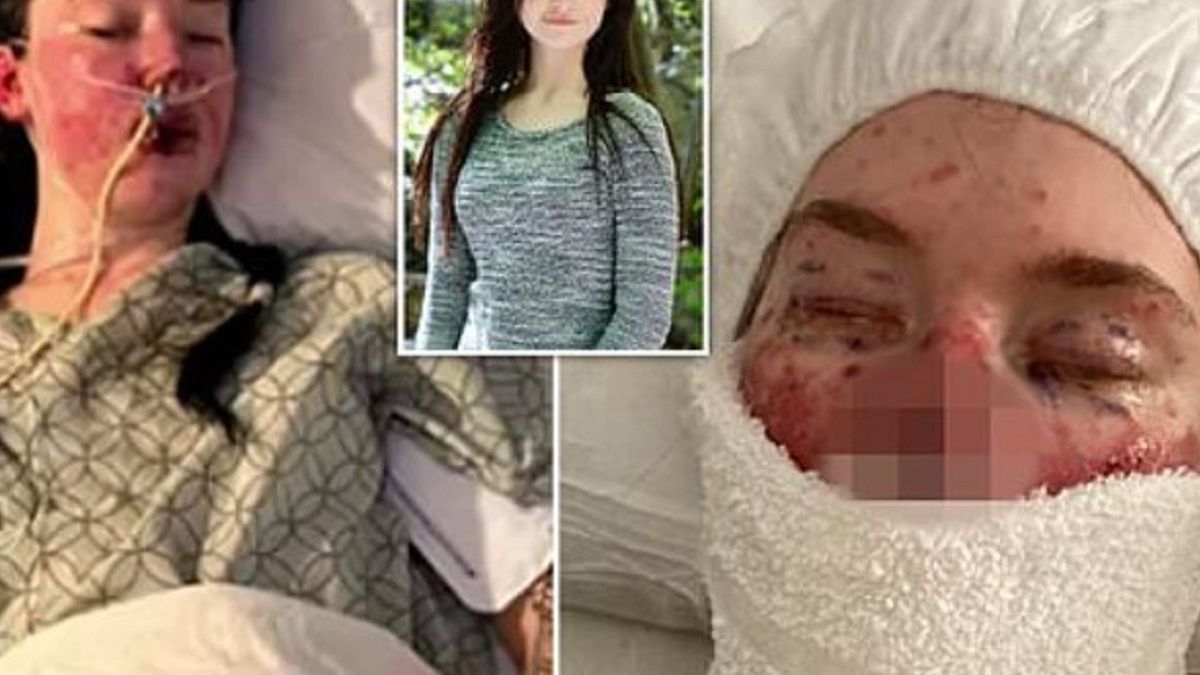 Szok! To stało się z jej twarzą. 