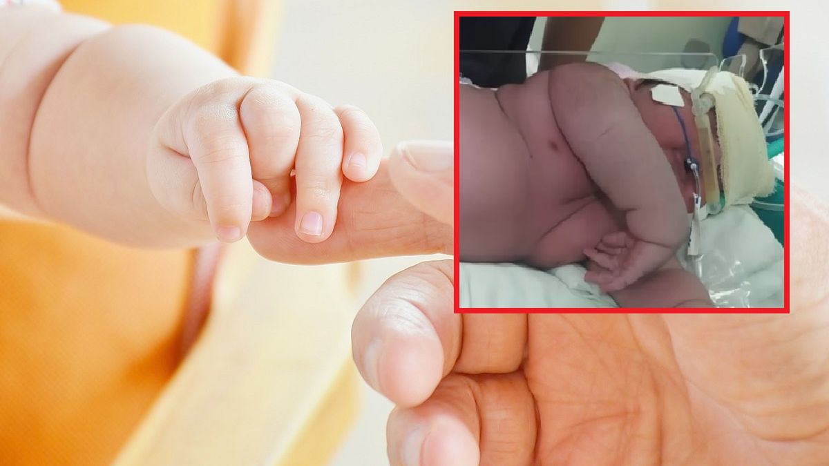 Ważył ponad 7 kg. Niezwykły poród w Brazylii