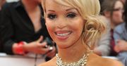 Katie Piper została oblana kwasem. Pokazała fotografię po operacji