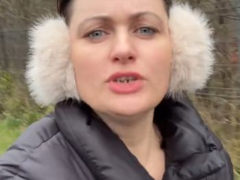 Cierpi na hipodoncję. "Moje zęby są wciąż tematem nr 1"