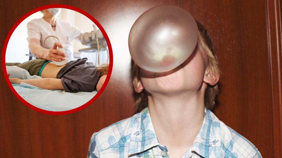 Chłopiec z gumą do żucia. Zdjęcie poglądowe