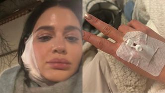 Honorata Skarbek trafiła na SOR. "Moja seria 'kocham poniedziałki' została brutalnie przerwana" (FOTO)