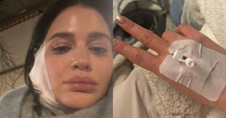 Honorata Skarbek trafiła na SOR. "Moja seria 'kocham poniedziałki' została brutalnie przerwana" (FOTO)