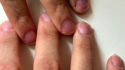 Paznokcie zdradzają więcej, niż myślisz. Sprawdź, czy nic ci nie dolega!