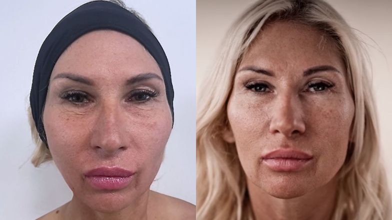 "Młodość na zamówienie". Metamorfoza Martiny zachwyciła jej przyjaciółki