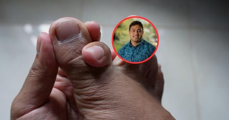 Główna przyczyna dny moczanowej. TikTok wprowadza w błąd ws. leczenia