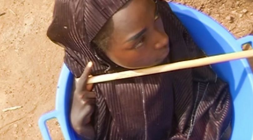 20-letnia kobieta cierpi na nieznaną chorobę. Musi być noszona w misce