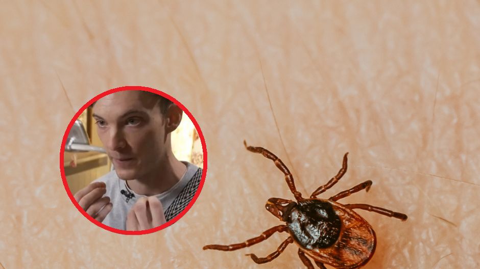 Ukąszenie kleszcza spowodowało nietypowe zaburzenie