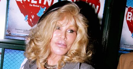 "Kobieta kot" przed operacjami. Kiedyś była blond pięknością