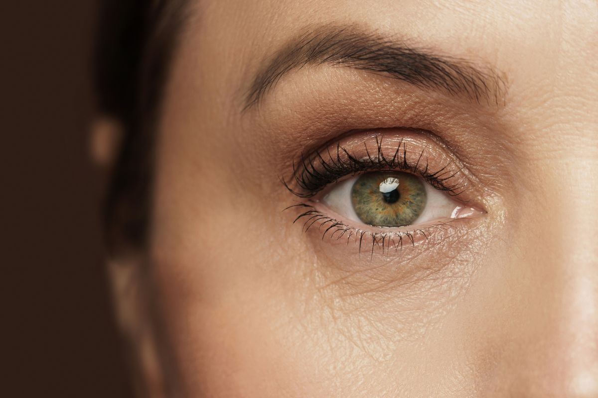 Diet affects skin condition.