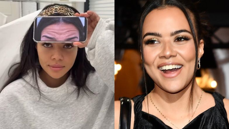 25-letnia Lexy Chaplin chwali się efektami BOTOKSU