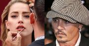 To Amber Heard ZNĘCAŁA SIĘ nad Johnnym Deppem? Aktor pokazał zdjęcie ze szpitala! (FOTO)