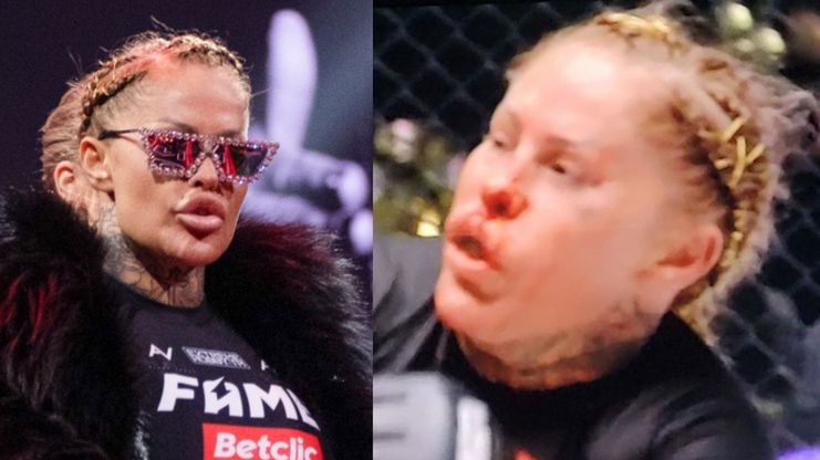 Laluna Unique i jej SKWASZONY NOS przegrywają walkę na Fame MMA