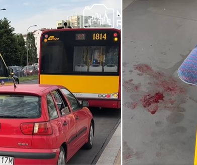 Roztrzaskał głowę w autobusie. Nie żyje
