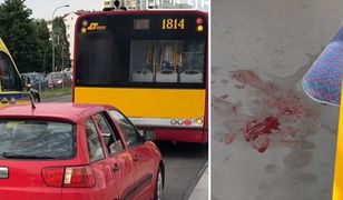 Roztrzaskał głowę w autobusie. Nie żyje