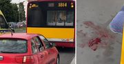 Roztrzaskał głowę w autobusie. Nie żyje