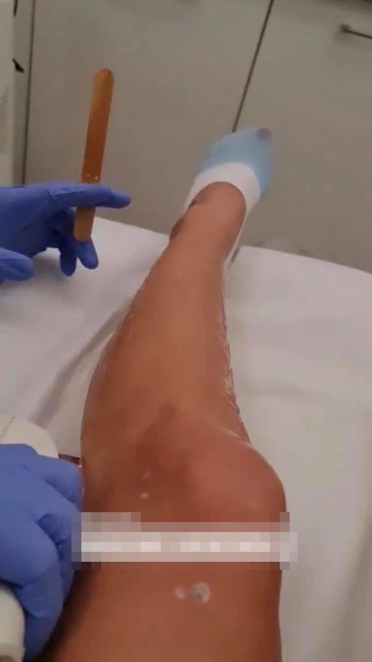 Sylwia Peretti odwiedza gabinet medycyny estetycznej