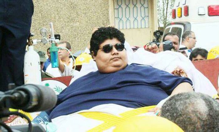 Najgrubszy człowiek świata - kim jest, leczenie otyłości olbrzymiej