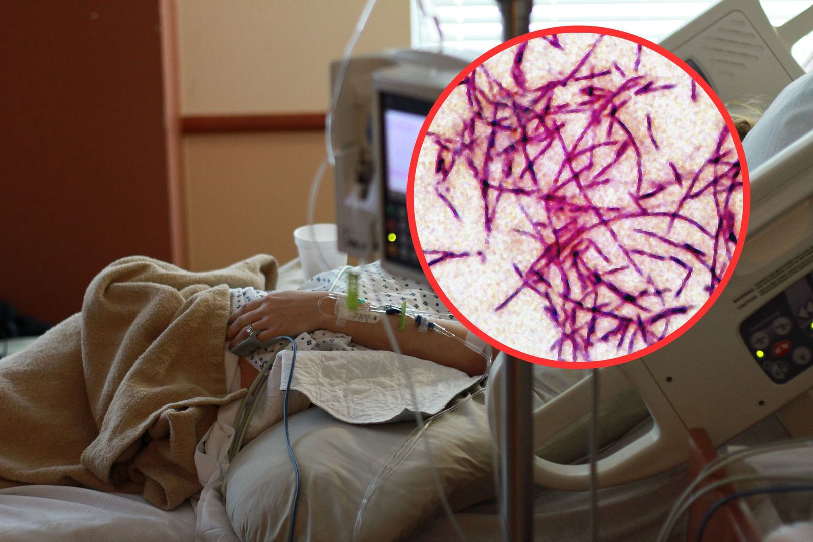 Legionella. Sposoby zarażenia, zapobieganie, leczenie. Coraz więcej zakażeń w Polsce