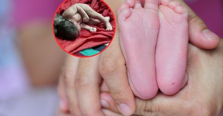Matka poczuła rozdzierający ból. Urodziła dziecko z trzema głowami
