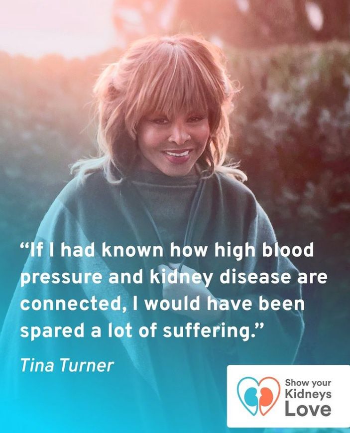 Tina Turner