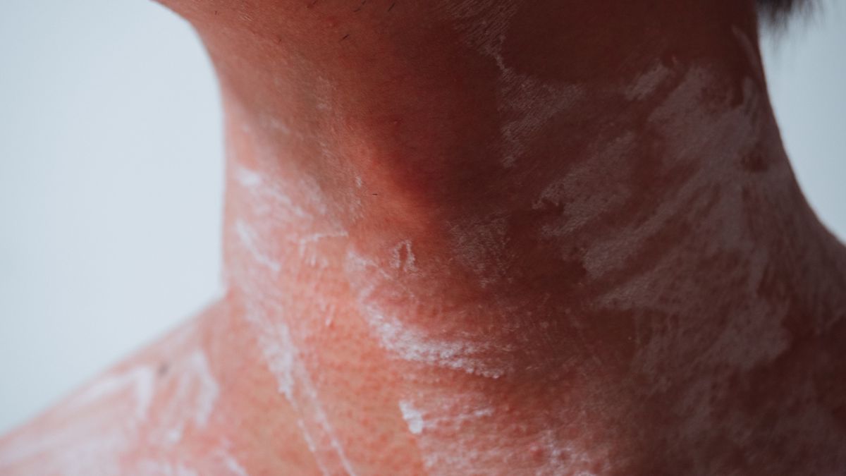 Rak ślinianki to jeden z rzadziej spotykanych raków. Jakie są jego objawy?