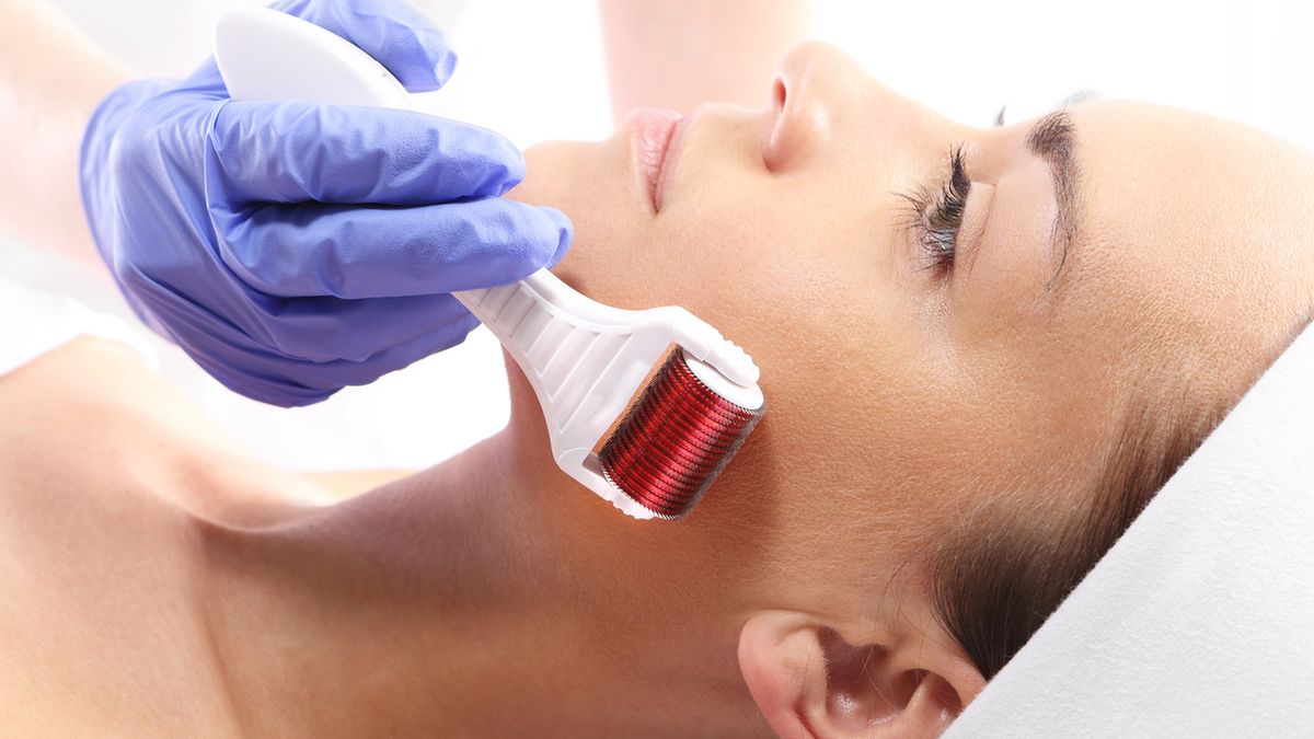 Mezoterapia mikroigłowa to jeden z najpopularniejszych zabiegów kosmetycznych na twarz.