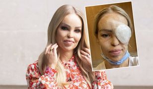 "Zawsze się tego bałam". Okulista potwierdził najgorsze