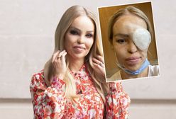 "Zawsze się tego bałam". Okulista potwierdził najgorsze