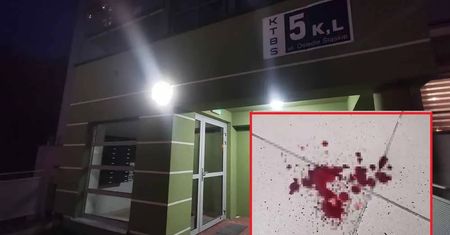 Brutalnie pobił kobietę w Zielonej Górze. Była zalana krwią. Sprawą zajmuje się policja
