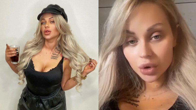 Ewel0na opowiada o operacji piersi