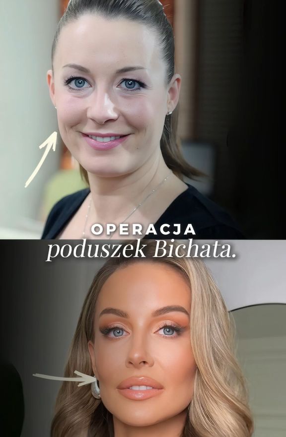 Specjalista przeanalizował przemianę twarzy Małgorzaty Rozenek