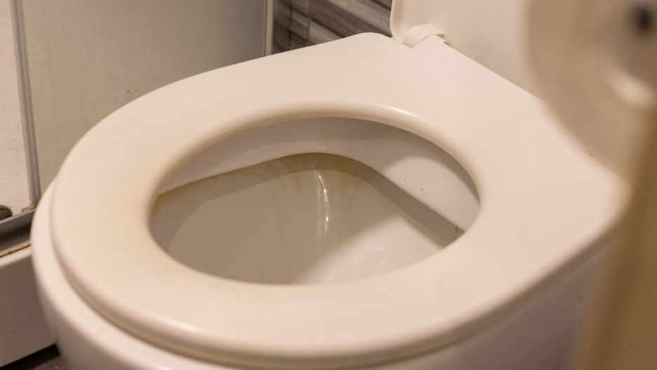 Domowy sposób na żółte zacieki na muszli klozetowej 
