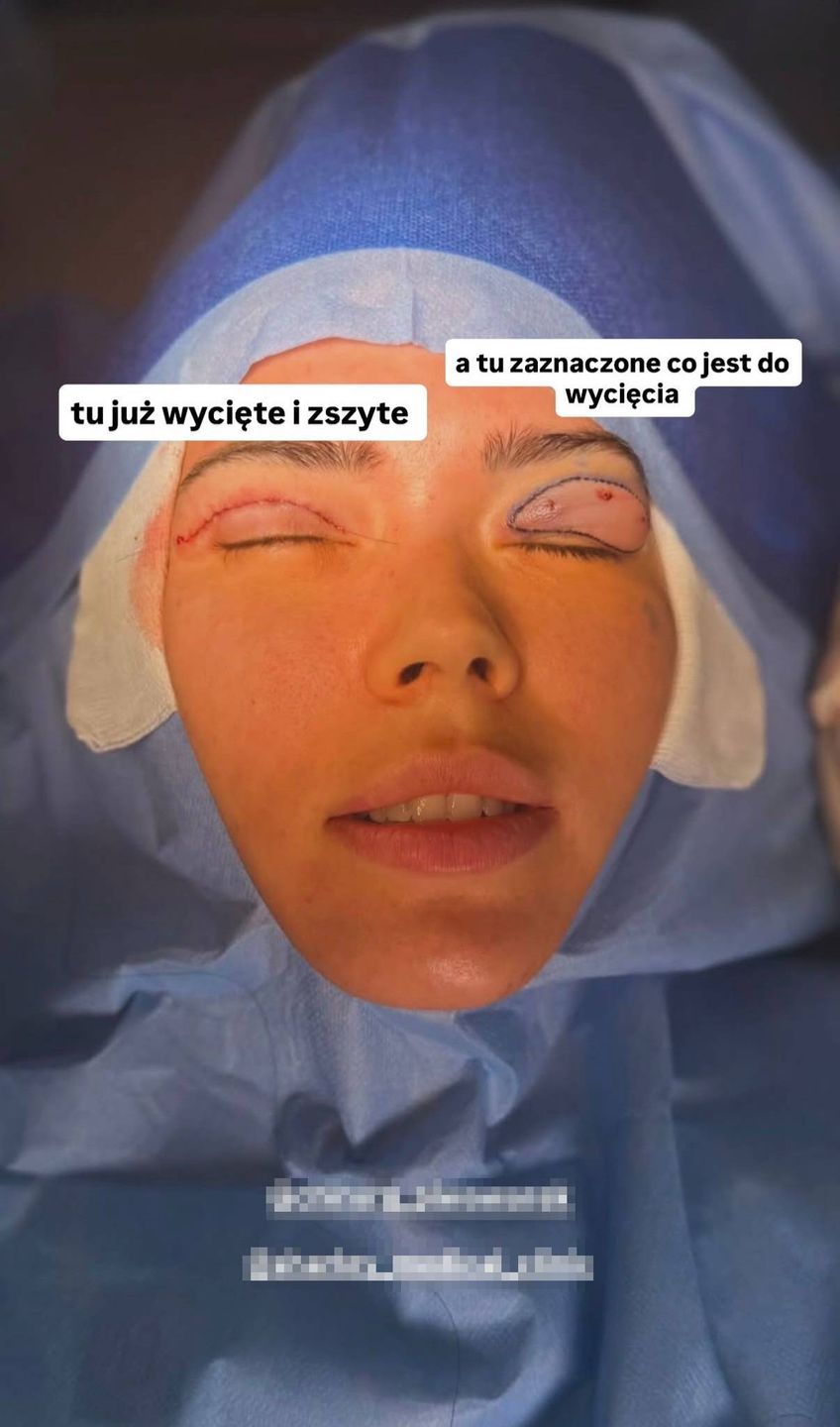 Sandra Kubicka po operacji