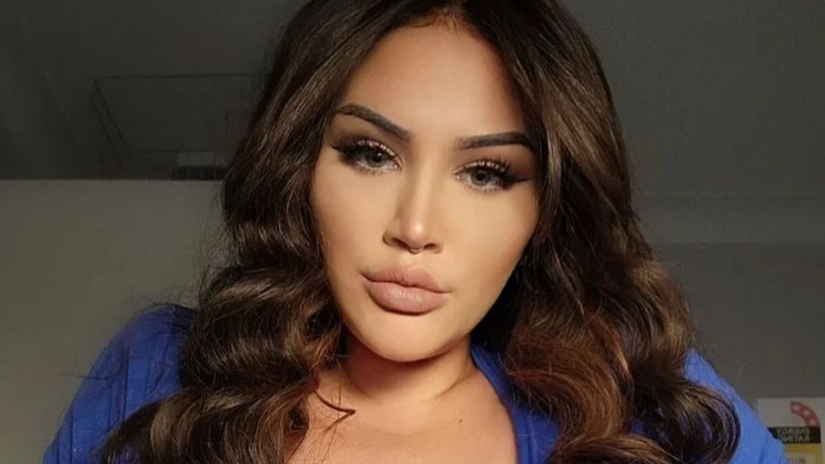 Pamela James cierpi na gigantomastię