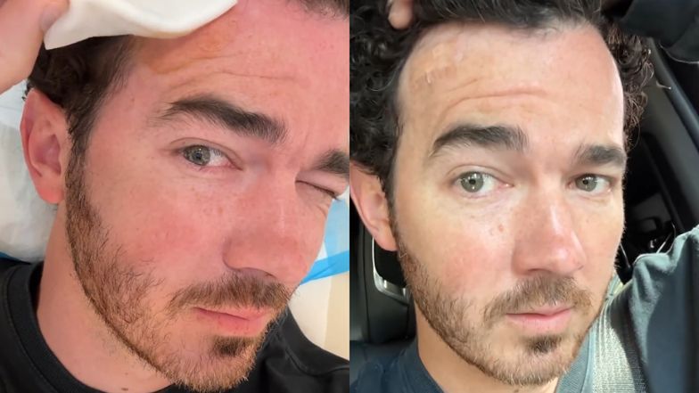 Kevin Jonas miał raka skóry