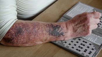 Śląsk: Przybywa stulatków. Najstarsza z osób ma 108 lat