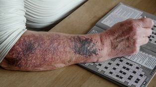 Śląsk: Przybywa stulatków. Najstarsza z osób ma 108 lat